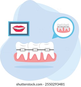 Alineadores de dientes o dispositivos ortopédicos con cable de metal con concepto de sonrisa Before After, diseño de Vector de dispositivos de tratamiento de ortodoncia lingual, símbolo de odontología, signo de atención médica, instrumento dental