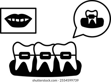 Teeth Aligners or metal wired braces with Before After smile concept, Lingual orthodontic treatment appliances vector design, Odontology symbol, manual dexterity sign Dentist tools stock illustration