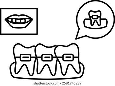 Teeth Aligners or metal wired braces with Before After smile concept, Lingual orthodontic treatment appliances vector icon design, Dentistry symbol, Healthcare sign, Dental instrument illustration