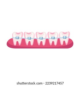 Teeth before braces cartoon illustration. Stage of dental alignment or treatment with usage of brackets for beautiful smile. Orthodontist, healthcare, medicine concept