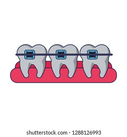 teeth with braces