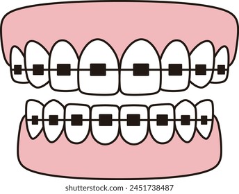 Teeth braces icons, Vector flat illustration