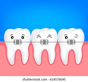 teeth braces illustration. Dental health care concept.