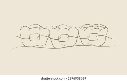 Teeth braces illustration drawing in linear style on beige color background