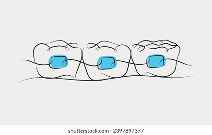 Teeth braces illustration drawing in linear style on white and blue background