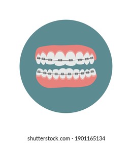 Teeth With Braces. Jaws  Isolated. Dentistry And Orthodontics Treatment. Flat Vector Illustration. Dental Row With With Braces