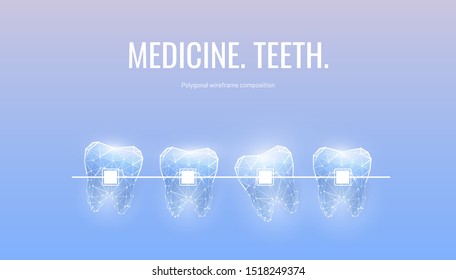 Dientes con prendas de bajo poste plantilla de banner. Diseño de póster de tratamiento ortodontico. Corrección de dientes desiguales con paréntesis ilustración poligonal. Tipografía innovadora de publicidad estomatológica