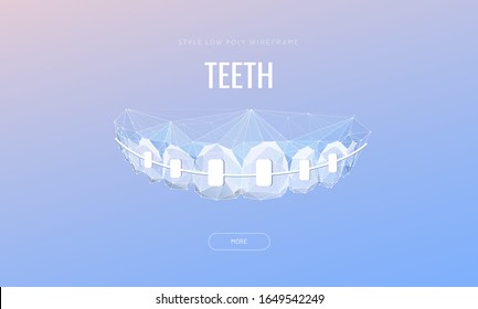 Teeth with braces low poly banner template. Orthodontic treatment poster design. Correcting uneven teeth with brackets polygonal illustration. Innovative stomatology advertising typography