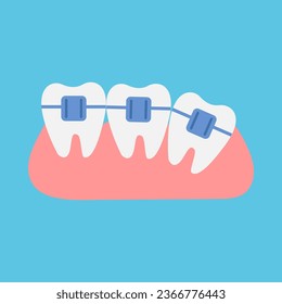 Teeth with braces on a blue background. Flat style. Vector