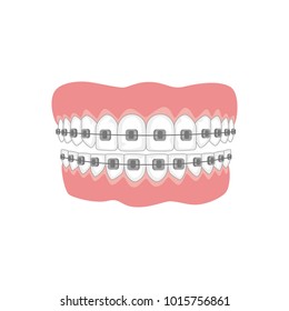 Teeth With Braces On White Background. Vector Illustration.

