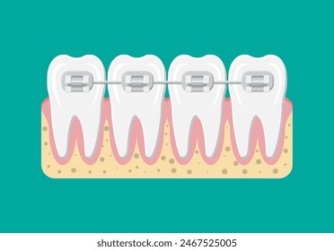 Teeth braces. Orthodontics and dentistry. Human tooth in flat style. Dental concept. Hygiene and oralcare. Vector illustration