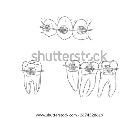Teeth with braces set illustration drawing in graphic style with black on white background.