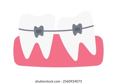 Teeth with braces, vector illustration. Concept of bite correction. Orthodontics.