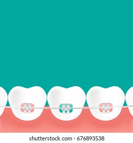 Teeth braces vector line icon isolated on white background. Teeth braces line icon for infographic, website or app. Scalable icon designed on a grid system.