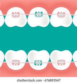 Teeth braces vector line icon isolated on white background. Teeth braces line icon for infographic, website or app. Scalable icon designed on a grid system.