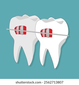 Teeth with braces.Orthodontic treatment stages