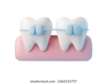 Teeth with a bracket frame installed on the gum, realistic render icon vector illustration isolated on white background. Infographics installation of corrective brace.