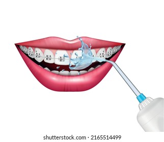 Teeth care oral hygiene realistic composition with dental irrigator cleaning braces vector illustration