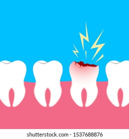 Teeth Caries Dental damage Pain Illustration Vector