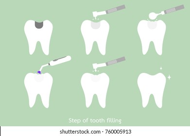 teeth cartoon vector flat style for design - step of caries to tooth amalgam filling with dental tools