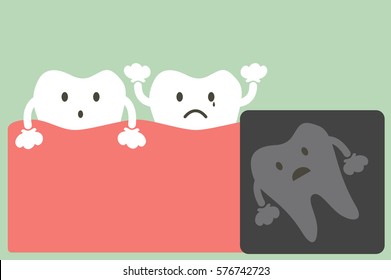 teeth cartoon vector, x-ray wisdom tooth