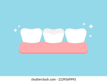 Teeth with ceramic overlay in gym dental icon. Tooth dentistry restoration with ceramic porcelain sealant in cavity treatment concept. Flat cartoon clip art vector illustration.