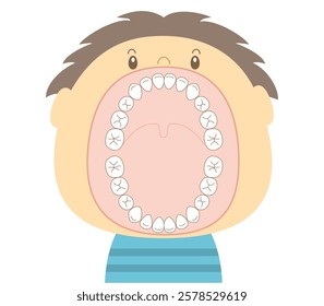 The teeth of a child in the mixed dentition stage with a wide-open mouth.