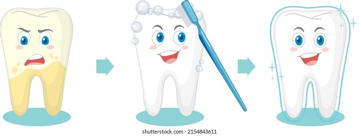 Teeth cleaning procedure on white background illustration