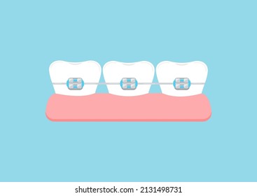 Dientes con llaves dentales en el icono del gimnasio. Corchetes dentales sobre el concepto de tratamiento de corrección de corchetes ortodoncicos de dientes blancos. Dibujo de dibujos animados tipo caricatura de diseño plano vectorial.