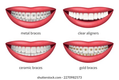 Teeth dental braces icons set with realistic human lips isolated vector illustration