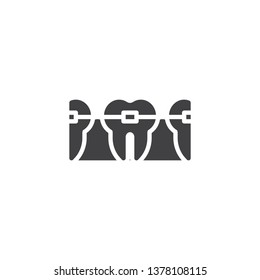 Teeth with Dental Braces vector icon. filled flat sign for mobile concept and web design. Dental care glyph icon. Symbol, logo illustration. Pixel perfect vector graphics
