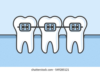 Teeth with dental braces vector illustration