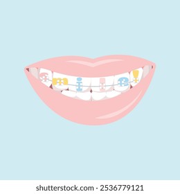 Teeth dental braces with word smile, isolated on white background, vector illustration in pastel calm colors.