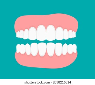 Teeth with dental in flat design. Flat Vector Concept. Dental Clinic, Stomatology Orthodontic Illness, Problem Illustration. Tooth Sickness Treatment, Oral Hygiene