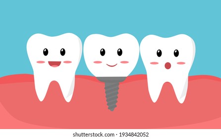 Teeth with dental implant cartoon in flat design. Tooth implant screw in gum.