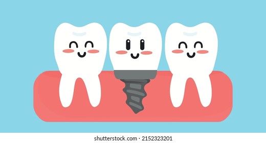 Teeth with dental implant cartoon in flat design. Tooth implant screw in gum.