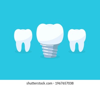 Teeth with dental implant icons on blue backgrund. Tooth symbol of dent clinic Vector illustration EPS 10