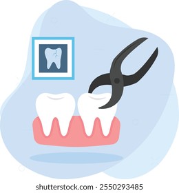 Extracción de dientes en el concepto de la clínica del dentista, extracción o extracción de dientes defectuosos utilizando alicates de odontología diseño de íconos de color de Vector, símbolo de odontología, signo de atención médica, instrumento dental ilustración de stock