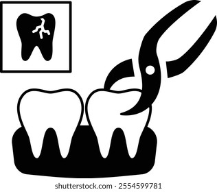 Teeth Extraction at dentist clinic concept, defected tooth pulling or removal using Odontology pliers vector outline design, Odontology symbol, manual dexterity sign Dentist tools stock illustration