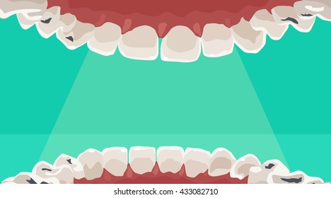 teeth flat vector mouth caries