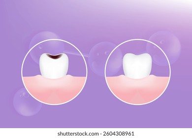 Teeth and gum care solutions ad, purple collagen with cosmetic advertising background ready to use, illustration vector.