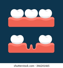 Teeth with Gum for Healthcare. Vector