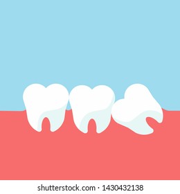 Teeth and gum problems. Impacted wisdom tooth for dentistry and dental surgery in flat style vector illustration