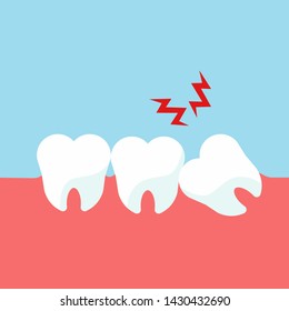 Teeth and gum problems. Impacted wisdom tooth for dentistry and dental surgery in flat style vector illustration