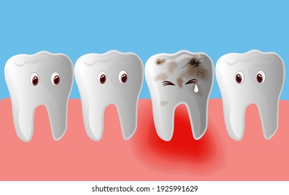 Teeth in the gums, cavities, damaged teeth, toothache Medical concept. Maintain your dental health Editable vector illustration