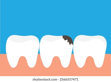 Teeth with Gums Tooth Decay. Health care and medicine concept vector art