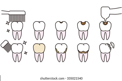 Teeth and gums trouble. Clean gums and trouble-some gums.