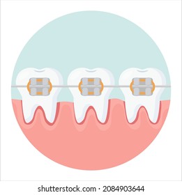 Teeth icon with braces on a blue background. Orthodontic treatment, teeth straightening with braces. 