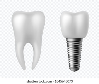 Teeth and implant. Dental surgery poster human white enamel tooth crown denture orthodontic technology. Artificial teeth dentistry implantation jaw vector realistic stomatology clinic isolated concept