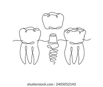 Teeth implant illustration drawing in flat line style on white background